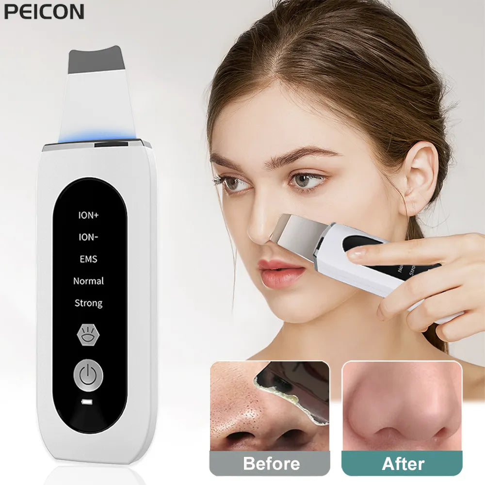 Ultrasonic Skin Scrubber Peeling Blackhead Remover Deep Face Cleaning